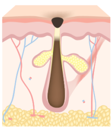 리엔장 여드름케어 모공막힘 이미지