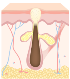 리엔장 여드름케어 염증발생 이미지