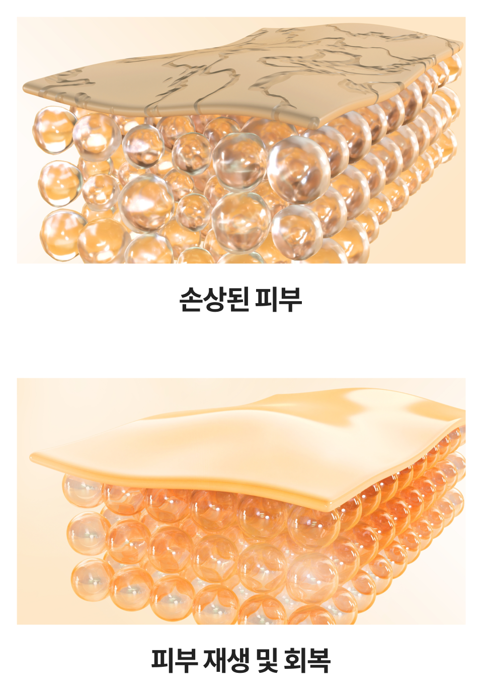 리엔장 아나파 스킨부스터 시술 과정 이미지 모바일