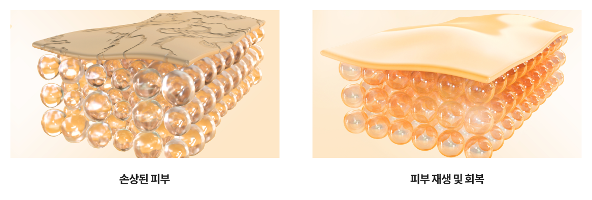 리엔장 아나파 스킨부스터 시술 과정 이미지